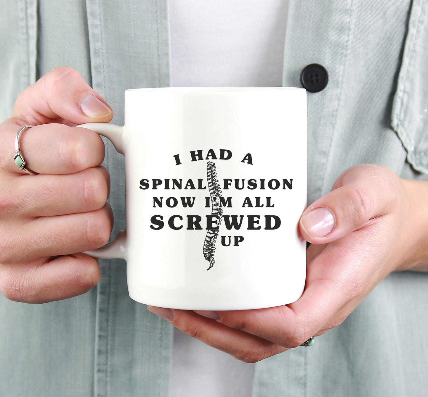 Spinal Fusion Mug - All Screwed Up, Funny Spinal Surgery Mug, Get Well Gift, Back Surgery Mug, Spinal Fusion Gift, Funny Post Surgery Gift